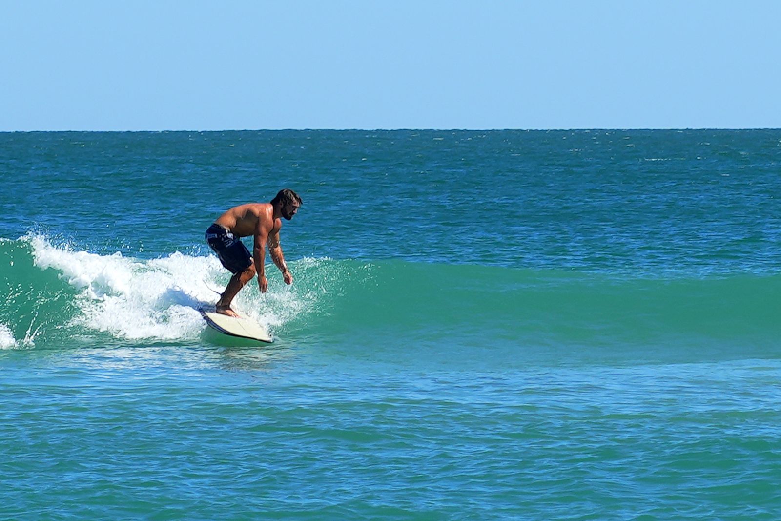 Turner low and compressed mid-face